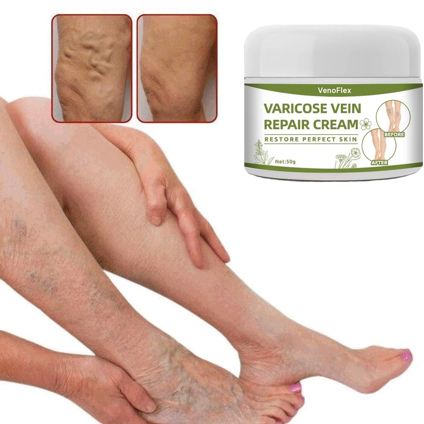 VenoFlex - Krema Za Proširene Vene