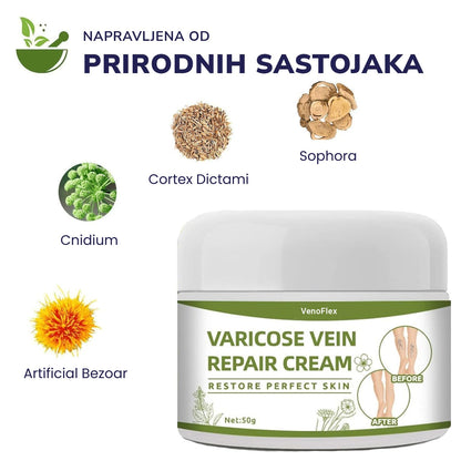 VenoFlex - Krema Za Proširene Vene